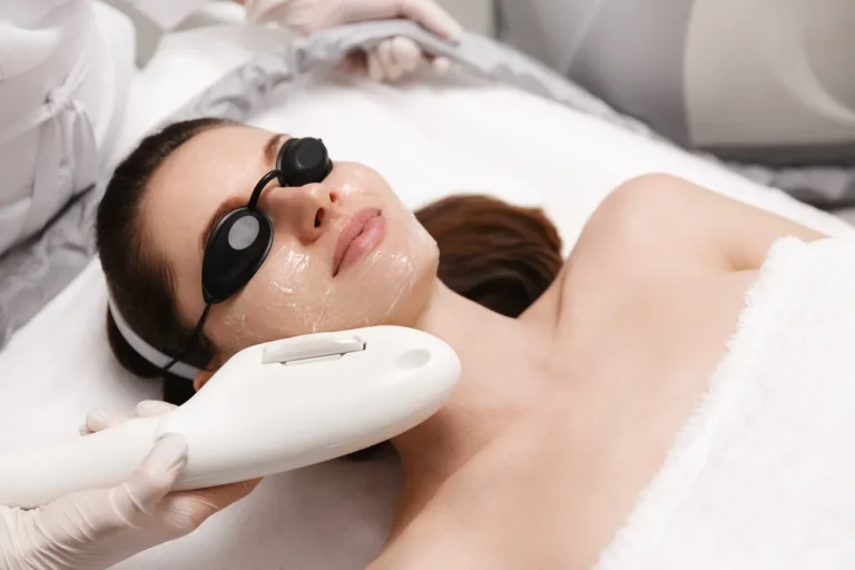 Photofacial